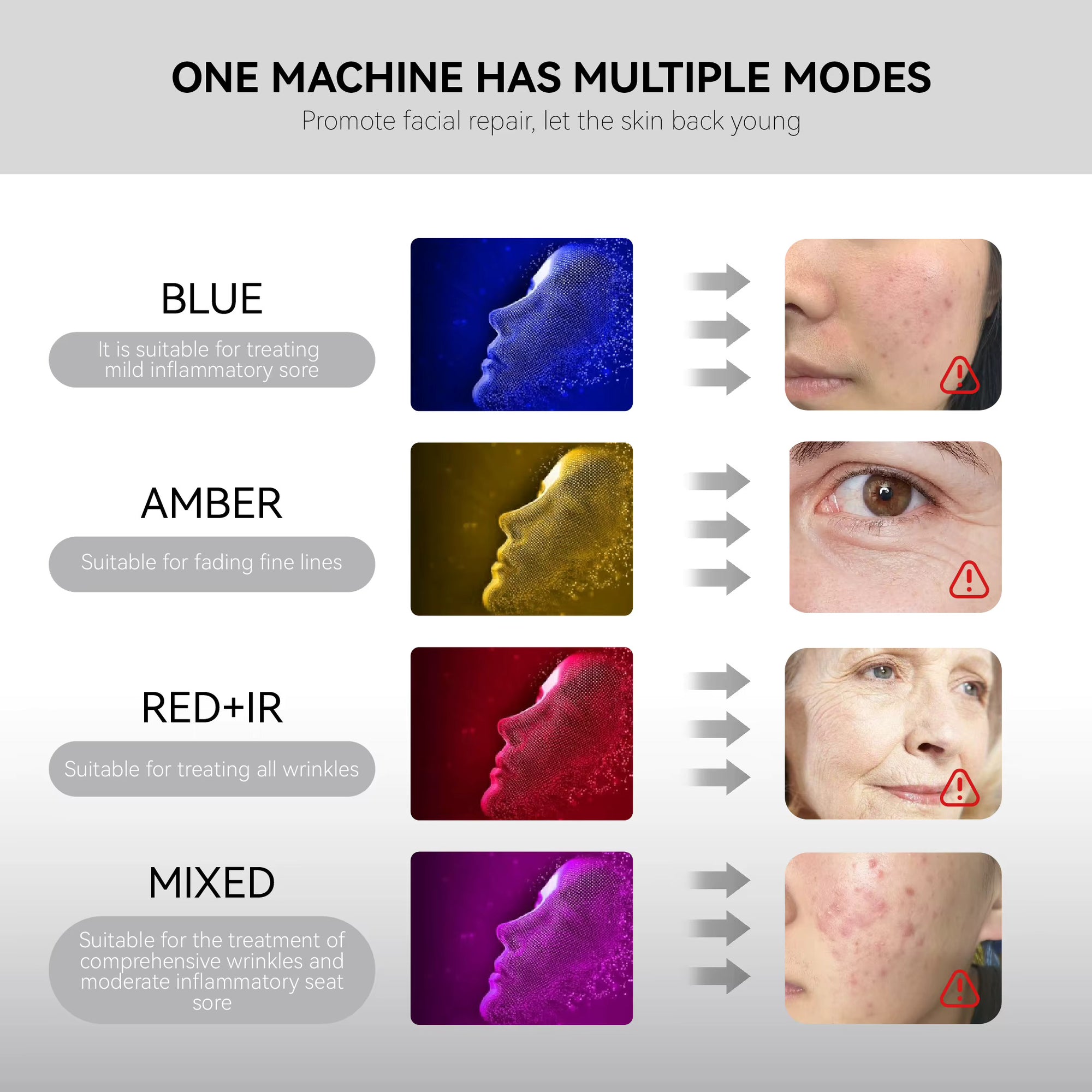 LED LIGHT THERAPY FACE MASK — ACNE, DARK SPOTS & COLLAGEN · 332 LEDs · CORDLESS